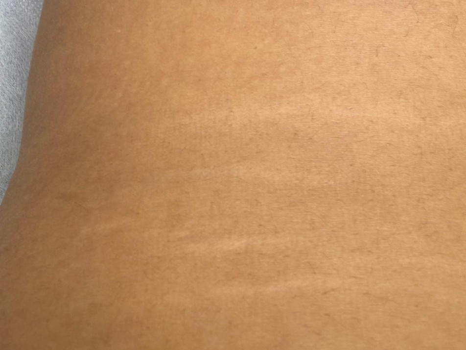 Kere külg, teine vaade — enne